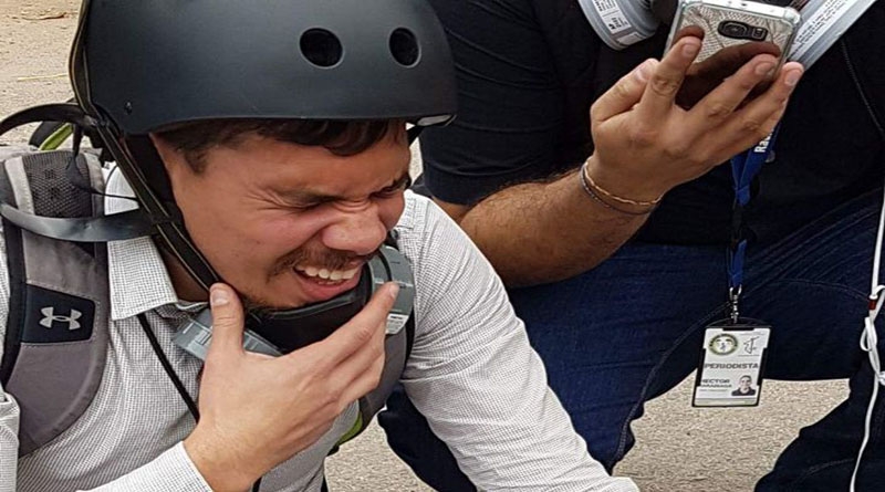 En la foto el periodista Dassaev Aguilar con fuertes dolores en su pierna por la bomba lacrimógena que policías le lanzaron el 20 de enero de 2018, hace un gesto de dolor