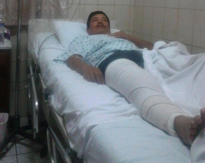 Víctor Vásquez. Presidente de MILPAH deberá estar tres meses en reposo después de operación por balazo en su rodilla en el desalojo violento contra campesinos de la Cooperativa 9 de Julio en San Pedro de Tutule, La Paz