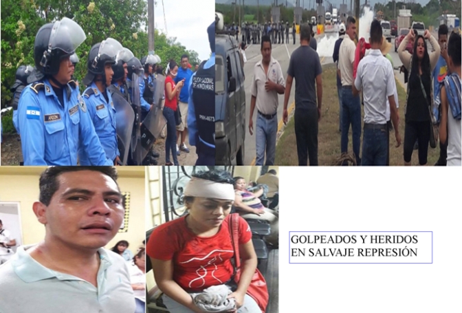 En las fotos abajo: el periodista Gerardo Chévez con golpes ocasionado por la policía cuando cubría la manifestación para radio progreso. La otra foto es de Daniela Menjívar 